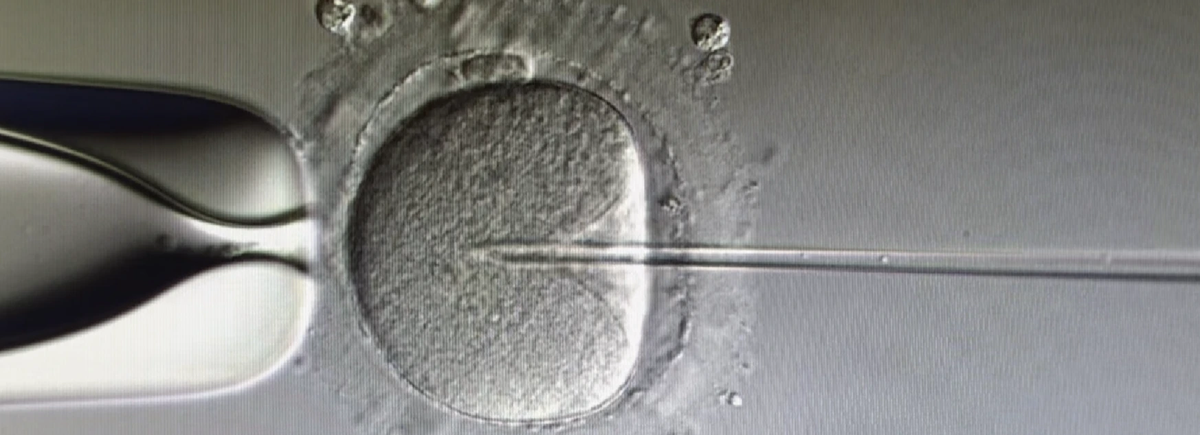 Fecundación In Vitro fecundación de embriones