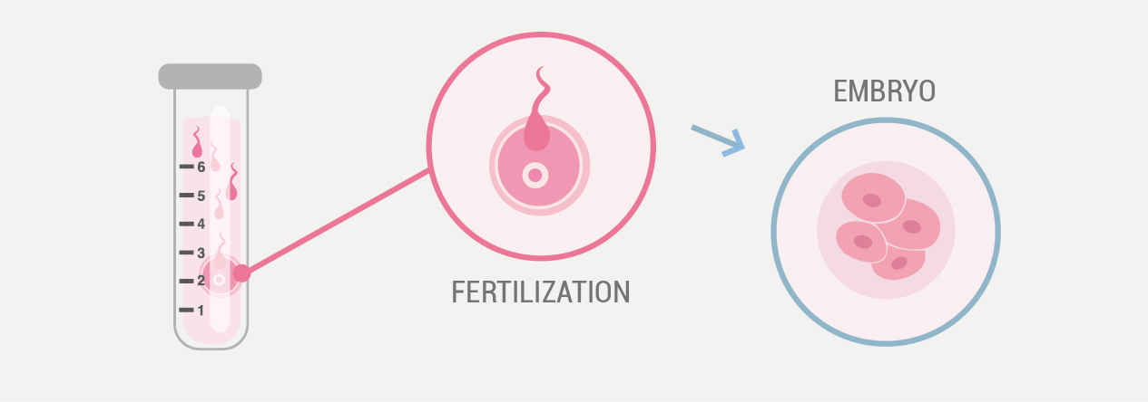 in vitro fertilization embryos