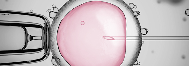 ICSI Intracytoplasmic Sperm Injection