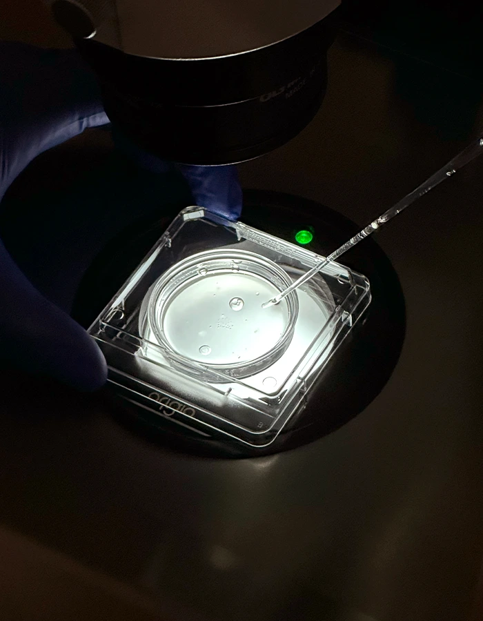 FIV Fecundación In Vitro Prueba