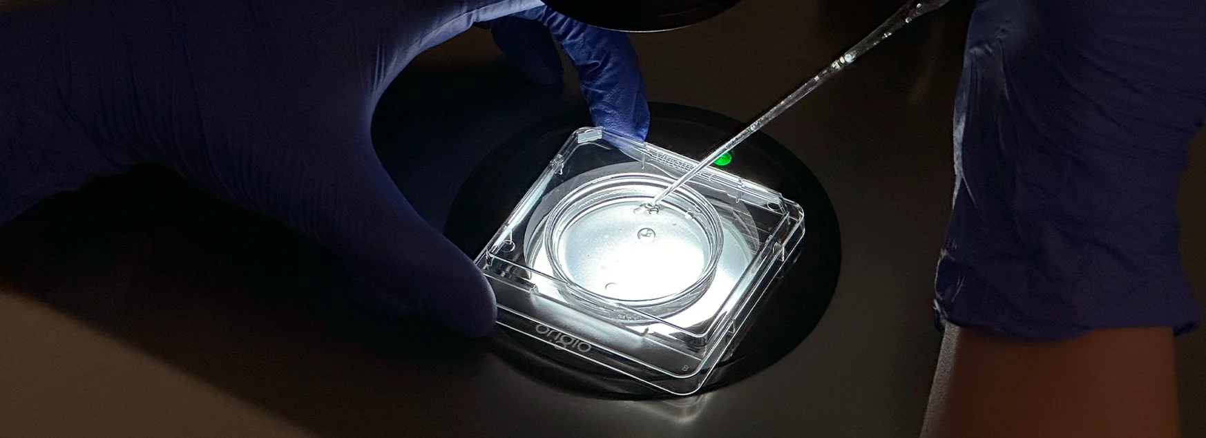 Fecundación In Vitro FIV punción folicular