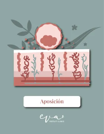 Imagen ilustrada de endometrio en fase de aposición