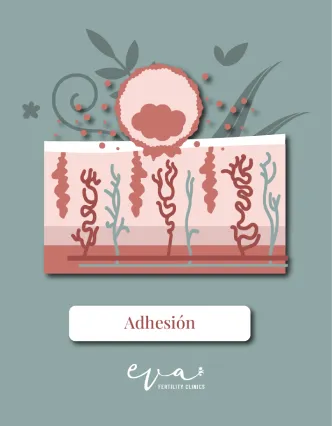 Imagen ilustrada de endometrio en fase de adhesión